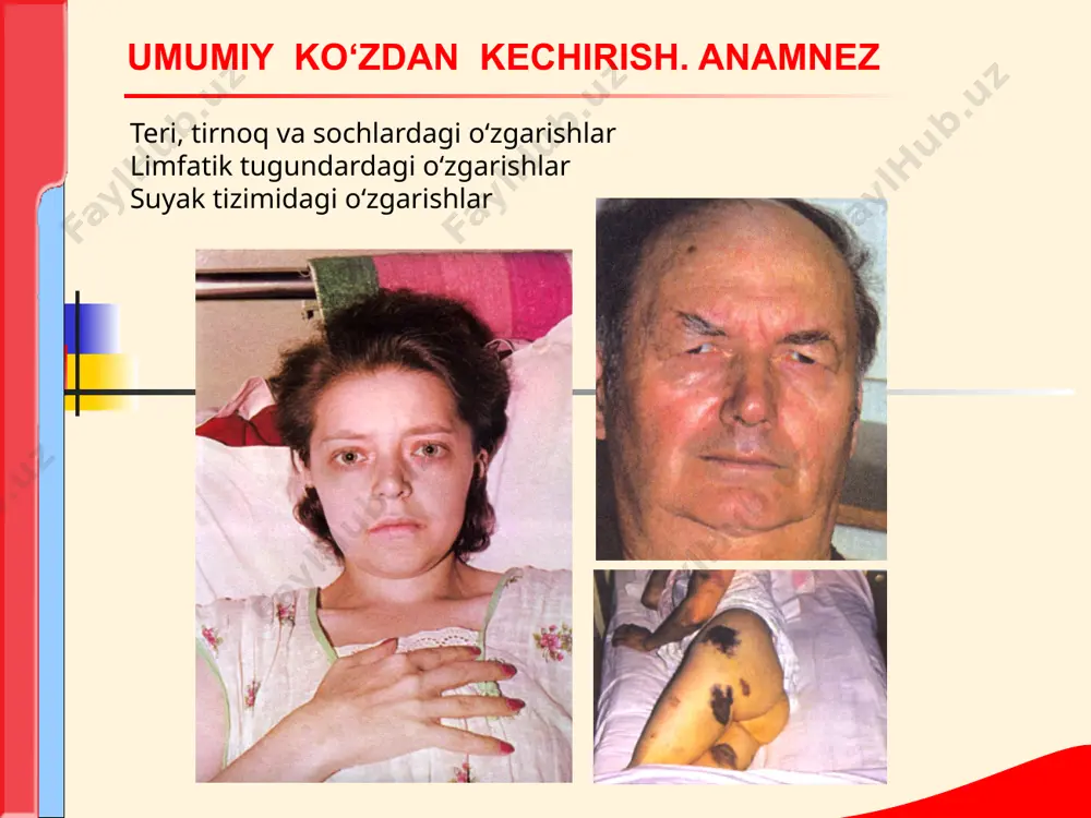 ashuvi gipoplastik sindrom (panmiyeloftiz) eʼtiboringiz uchun raxmat! image1.png image2.png image3.png image4.png image5.png image6.png image7.png image8.png image9.png image10.png image11.png image12.png image13.png image14.png image15.png image16.png image17.png image18.png image19.png image20.png image21.png image22.png image23.png image24.png image25.png /docprops/thumbnail.jpeg