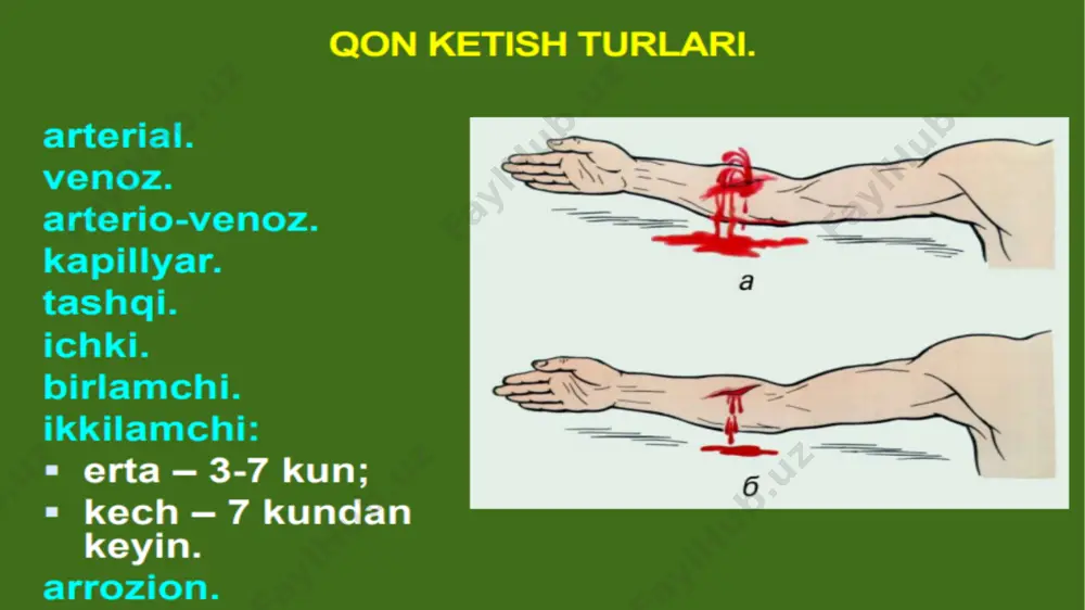 qon tomirlar operativ jarrohligi - Page 3