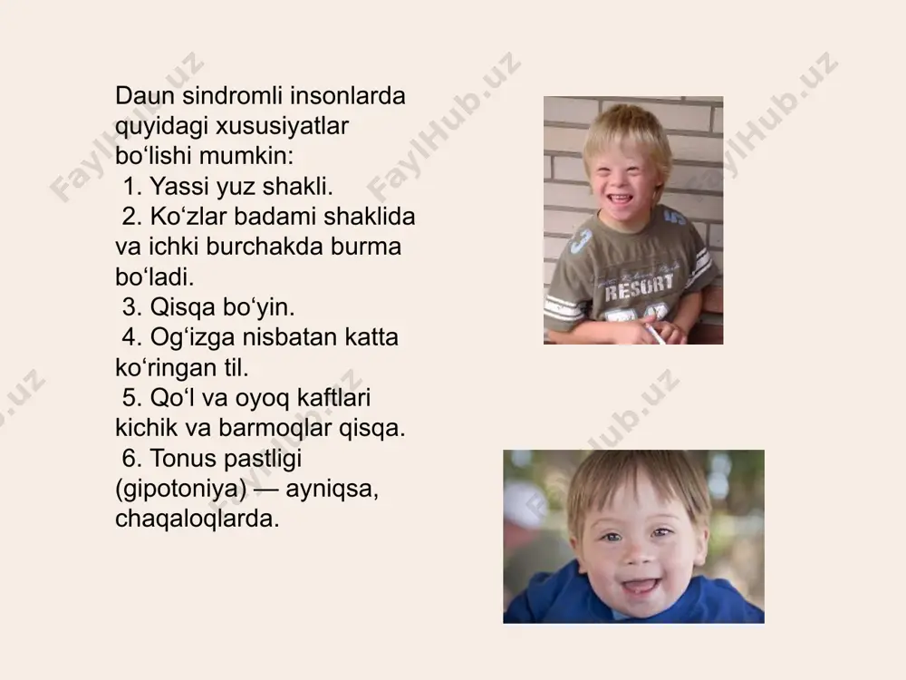 daun sindromi - Page 3