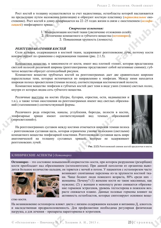 v i gubchatix kostey daet teni v vide uzkix (tonkix) svetlix polos, knutri ot kotorix vidna set gubchatogo veshestva. razlichnie vistupi na kostyax (bugri, bugorki, otrostki, osti, nadmishelki i t.p.), a takje tochki okosteneniya na rentgenogrammax imeyut vid svetlix obrazova- niy («zatemneniya») sootvetstvuyushey formi. razlichnogo roda otverstiya, kanali, uglubleniya, borozdi, polosti v kostyax, epifizarnie xryashi imeyut sootvetstvuyushiy vid temnix obrazovaniy («prosvetleniy»). na rentgenogrammax sustavov mejdu kostyami otmechaetsya shirokaya temnaya polosa  rentgenovskaya sustavnaya shel, kotoraya ogranichena uzkimi poloskami (svetlimi) kompaktnogo veshestva epifizarnoy plastinki. rentgenovskaya sustavnaya shel shire anatomicheskoy na tolshinu sustavnix xryashey, kotorie ne zaderjivayut rentgenovskix luchey. klinicheskie aspekti | osteoporoz osteoporoz – eto sostoyanie povishennoy «poristosti» kosti, pri kotorom razrushenie (rezorbtsiya) kosti preobladaet nad obrazovaniem (osteosintezom). pri dannoy patologii iz organizma vivo- ditsya bolshoe kolichestvo kaltsiya, on teryaetsya s mochoy i potom. u patsientov s osteoporozom chasto voznikayut spontannie perelomi iz-za xrupkosti kostnoy tka- ni. chashe boleyut lyudi pojilogo …
