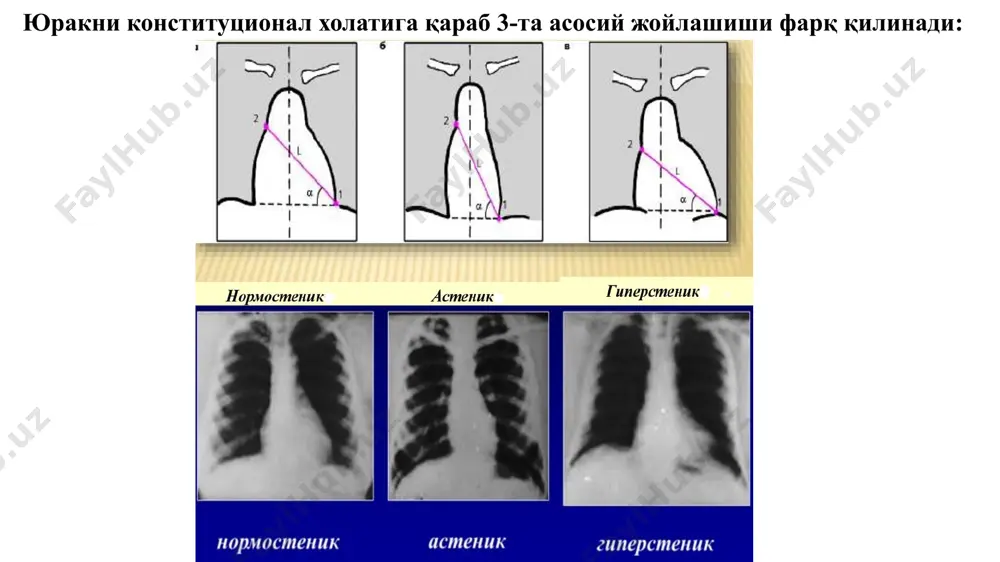 йди. миокардитларда юрак контурлари ёйларида оз бўлса хам пульсация сезилмайди, фақат қон томирлар тутамида пульсацияни сезиш мумкин. миокард ва перикардларни умумий катталашувига “ буқа юраги-cor lovinum-бычье сердце” дейилади. микрокардия юракнинг туғма пороклари радионуклид текшириш. те۹۹ᵐ-пирофосфат-миокарднинг некроз жойига йиғилади (400-600 мбк қонга юбориб, гамма камерада визуализация қилинади). соғлом жойга йиғилмайди. таллий – 201 – хлорид (80 мбк) қонга юборилади. бу изотоп миокарднинг соғлом тўқимасида тўпланади, некроз қисмида йиғилмайди. image1.png image2.png image3.png image4.png image5.png image6.png image7.png image8.png image9.jpeg image10.png image11.jpeg image12.png image13.png image14.png image15.png image16.png image17.png image18.png image19.png image20.png image21.png image22.png /docprops/thumbnail.jpeg