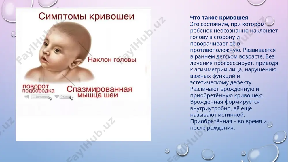 ссаж при кривошее для грудничков если патология приобретённая, массаж помогает очень хорошо, однако заметный эффект развивается не сразу. обычно первые положительные сдвиги наблюдаются к концу первого курса, заметные улучшения видны после 2–3 курсов. после решения проблемы, необходимо в течение 2–3 лет делать поддерживающие курсы дважды в год, чтобы кривошея не появилась снова. при врождённой кривошее массаж используется как один из компонентов комплексной терапии. возможные осложнения мышечной кривошеи если не лечить кривошею, скорее всего, разовьются серьёзные проблемы. часть кровеносных сосудов, питающих головной мозг, зажимаются спазмированной мышцей. в результате мозг хуже кровоснабжается. ребёнок испытывает головные боли, которые лишь кратковременно купируются медикаментами. в связи с этим малыш становится капризным, легко раздражается, быстро утомляется. он плохо запоминает самые простые вещи, что мешает ему учиться в школе, колледже и даже вузе. уже в подростковом возрасте присоединяются приступы повышенного внутричерепного давления. всё это ухудшает жизнь малыша и его родителей. а решение простое – своевременно диагностировать патологию …