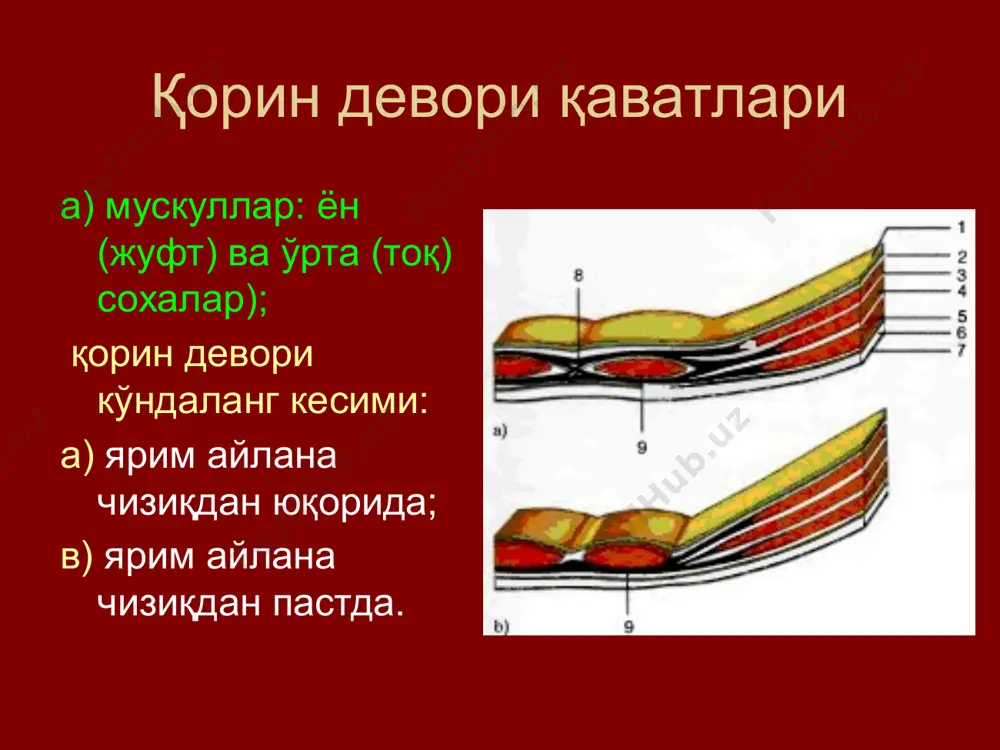 4. чов кесими чурра кесиш учун қийшиқ-ўзгарувчан қовурға ости кесими бурчакли кесимлар федоров қовурға ости кесими рио-бранко медиал-бурчакли кесими мейо-робсон латерал-бурчакли кесими ильин кесими кер кесими кўндаланг кесимлар бунда кенг қийшиқ мускуллар йўналиши бўйича кесилади, бир ёки иккала тўғри мускуллар кесилиши мумкин (пфанненштил, черни кесимлари). афзалликлари: томир-нерв тутамларининг сақланиши кесим латерал томонга то ўрта қўлтиқ ости чизиғигача узайтирилиши мумкин яра қирғоқлари яхши битади камчилиги: чекланганлиги - фақат юқори ёки пастки қават аъзоларини очиш мумкин тўғри мускулларни кесиш ва бирлаштириш машаққатлилиги лапароскопия услубининг афзалликлари: очиб киришда камшикастлилик ва операция бажариш муддатининг қисқариши; «жарроҳлик оқибатида» қон йўқотилишининг озлиги; операциядан кейинги асоратлар частотасининг пастлиги; беморларнинг касалхонада ётиш муддатларининг қисқариши; даволашнинг узоқ муддатлардаги натижаларининг яхшиланиши. кўрсатмалар диагностика мақсадида: даволаш мақсадида: лапароскопияга монеликлар қорин олд деворидаги операциядан кейинги кўп сонли чандиқлар; ичакнинг яққол ифодаланган кўпчиши; бемор терминал ҳолатда бўлганда; қорин бўшлиғида битишмали жараён (ич терлама ва ҳ.к.). лапароскопия техникаси асосий босқичлари пневмоперитонеум қўйиш (қорин бўшлиғига …