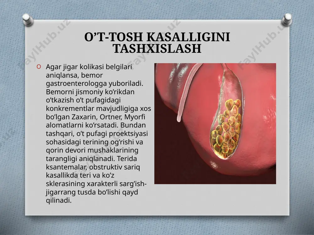 o't tosh kasalliklari - Page 4