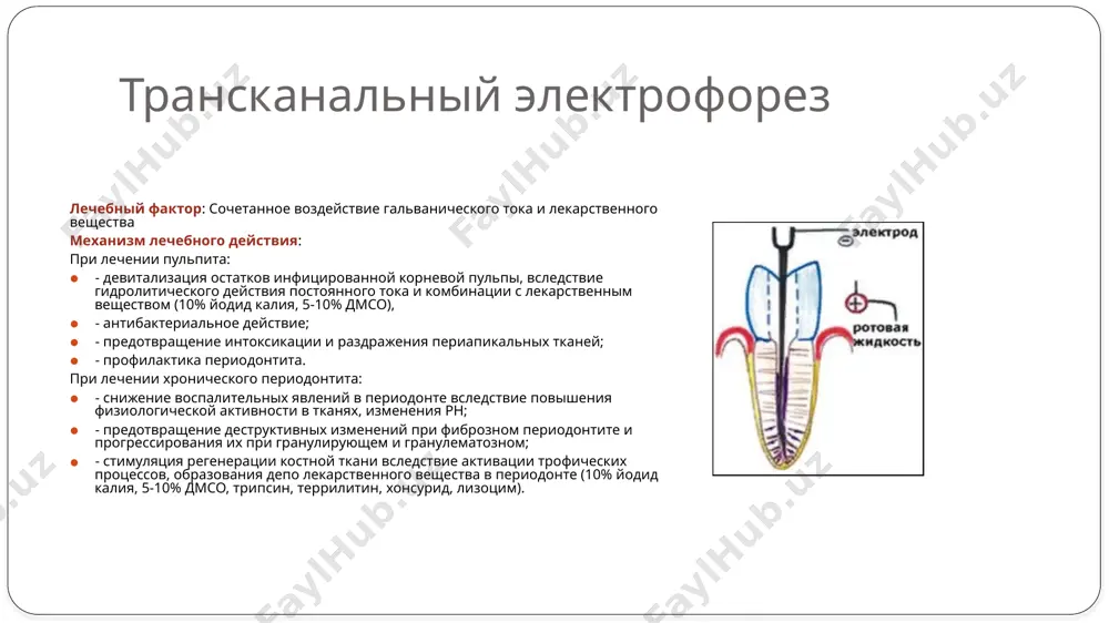 катализатором (хлорамин). проходимую часть канала пломбируют резорцин-формалиновой пастой. на устье канала накладывают изолирующую прокладку. коронку зуба восстанавливают постоянным пломбировочным материалом. недостатки метода 1. все резорцин-формалиновые препараты окрашивают твердые ткани зуба в розово-кофейный цвет, поэтому применяются только для моляров и не применяются на фронтальной группе зубов. 2. резорцин-формалиновая смесь в процессе полимеризации сокращается в объеме, отстает от стенок канала, поэтому импрегнация проводится трижды. 3. резорцин-формалиновая смесь после импрегнации в канале не рентгеноконтрастная. 4. метод лечения пульпита девитальной ампутацией - многосеансный метод, т. е. лечение проводится в 3-4- посещения. 5. попадание резорцин-формалиновой жидкости на слизистую оболочку полости рта вызывает ее ожог, а при длительном воздействии - некроз. 6. препараты, применяемые для мумификации корневой пульпы, могут оказывать токсический, сенсибилизирующий, канцерогененный, мутагенный эффекты. формальдегид, который является действующим началом формалина, оказывает неблагоприятное воздействие на периодонт. у больных иногда может отмечаться постоянная ноющая боль, боль при накусывании на зуб, боль при перкуссии. 7. резорцин-формалиновый метод не …