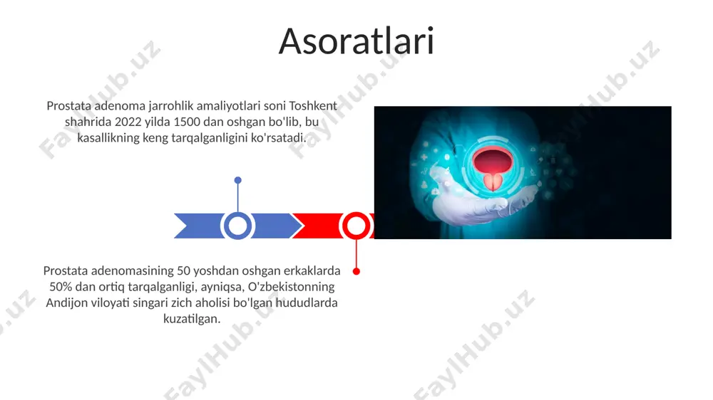 ml dan yuqori ko'rsatkichlar qo'shimcha tekshiruvlarni talab qilishi mumkin, masalan, transrektal ultratovush tekshiruvi toshkent shahri diagnostika markazlarida amalga oshiriladi. prostata bezining magnit-rezonans tomografiyasi (mrt) prostata adenomasining hajmini, joylashuvini va tarqalishini aniqlashda yuqori aniqlikni ta'minlaydi; bu usul samarqanddagi zamonaviy tibbiyot muassasalarida mavjud. tashxis qo'yish usullari prostata adenomasining sabablari prostata adenomasining rivojlanishida 50 yoshdan oshgan erkaklarning 80% gacha bo‘lgan qismi xavf ostida bo‘lib, andijon viloyatida o‘tkazilgan tadqiqotlarda bu ko‘rsatkich biroz yuqoriroq qayd etilgan. gormonlar muvozanatining buzilishi, xususan, testosteron va dihidrotestosteronning yuqori miqdori prostataning giperstimulyatsiyasiga va adenoma hosil bo‘lishiga olib kelishi mumkin, bu jarayon 40 yoshdan keyin tezlashadi. prostata adenomasining ta'rifi dunyo bo'ylab, xususan, g'arbiy evropa va shimoliy amerikada, prostata adenomasining tarqalish ko'rsatkichi yuqori bo'lib, 60 yoshdan oshgan erkaklarning taxminan 50% da aniqlanadi. bu esa, keksa yoshdagi erkaklar orasida tez-tez uchraydigan urologik muammolar qatoriga kiradi. prostata adenomasi, ko'pincha 50 yoshdan oshgan erkaklarda uchraydigan, prostata bezining benign (yaxshi sifatli) o'smasi bo'lib, siydik chiqarish yo'llariga …