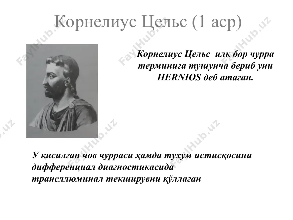р ҳосил бўлиши чурра дарвозаси ўлчамларини катталашиши тери мацерацияси ноқулайликлар чурраларда жарроҳлик амалиётнинг босқичлари кесма чурра қопини ажратиш чурра дарвозасини кенгайтириш чурра қопини очиш чурра қопини олиб ташлаш чурра дарвозасини пластикаси чов чуррасидаги кесма киндик чуррасидаги кесма ва пластика усуллари 1- сапежко 2- мейо 3- лексер чурра қопини ажратиш чурра дарвозасини кенгайтириш чурра қопини очиш ва чурра маҳсулотини қорин бўлиғига киритиш чурра қопини олиб ташлаш сирпанувчи чурра бунда чурра қопи билан бирга ички аъзони кесиб қўйиш ҳавфи юқори чурра дарвозаси пластикаси лихтенштейн операцияси трабукко бўйича чокларсиз герниопластика лапароскопик чурра кесиш корбит усули da vinci – масофадан жарроҳлик амалиётини бажариш ускунаси da vinci – масофадан жарроҳлик амалиётини бажариш ускунаси da vinci – масофадан жарроҳлик амалиётини бажариш ускунаси da vinci – масофадан жарроҳлик амалиётини бажариш ускунаси чов, сон, киндик, қорин оқ чизиғи ва амалиётдан кейинги чурралар чов чуррасини урганиш тарихи чурра хакида биринчи маълумот кадимги миср папирусларида топилган (м.а.1500 йиллар). чов каналида …