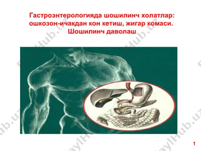 гастроэнтерологияда шошилинч холатлар - ошкозон-ичакдан кон кетиш, жигар комаси. шошилинч даволаш — PPT