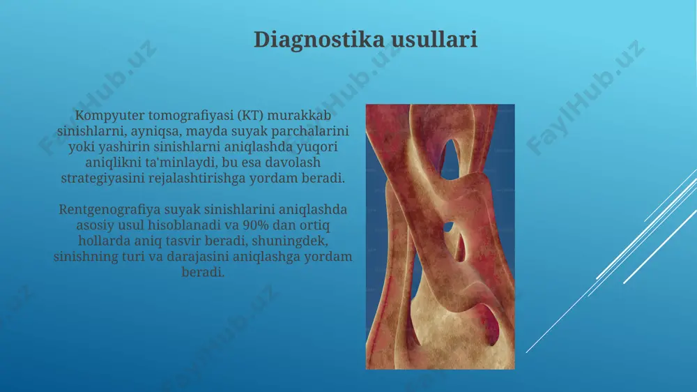 g'ri ovqatlanish suyak mineral zichligini pasaytiradi, natijada osteoporoz rivojlanishi va 20% gacha sinish xavfini oshiradi. reatabilitatsiya va tiklanish to'liq funktsional tiklanishga erishish uchun fizioterapiya, shu jumladan, 12 hafta davomida muntazam mashqlar, 60% gacha og'irlik ko'tarish va reabilitatsiya dasturi muhim ahamiyatga ega. suyak sinishi tuzalishining tezligi individual xususiyatlarga, masalan, bemorning yoshi (20-30 yoshdagilar tezroq tuzaladilar), umumiy sog'lig'iga va to'g'ri davolanishga bog'liq bo'lib, odatda 6-8 hafta davom etadi. genetik omillar ba'zi genlarning mutatsiyalari, masalan, 1-toifa kollagen geni (col1a1) va 1-toifa kollagen geni (col1a2) ning o'zgarishi osteogenez imperfektasiga olib kelishi mumkin, bu esa suyak sinishiga moyillikni oshiradi. lrp5 va vdr kabi genlardagi genetik variantlar suyak mineral zichligiga ta'sir qiladi va natijada, suyak sinishi xavfini 2 baravarga oshirishi mumkin. e'tiboringiz uchun rahmat @taqdimot_robot image1.jpg image2.jpg image3.jpg image4.jpg image5.jpg image6.jpg image7.jpg image8.jpg image9.jpg image10.jpg image11.jpg image12.jpg image13.jpg image14.jpg image15.jpg image16.jpg image17.jpg