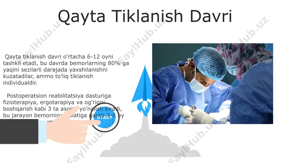 a nisbatan kamroq to'qima shikastlanishi va tezroq tiklanishni ta'minlaydi, muvaffaqiyat darajasi 90% dan yuqori. orqa miya churrasini jarrohlik yo'li bilan tuzatishda laminotomiya yoki laminektomiya kabi turli xil jarrohlik texnikalari qo'llaniladi, bu esa churraning o'lchamiga va joylashuviga bog'liq holda tanlanadi va taxminan 10% hollarda qo'shimcha fiksirlash kerak bo'ladi. 06 05 04 operatsiya oldidan tayyorgarlik 01 02 operatsiyaga tayyorgarlik jarayonida bemorga antikoagulyantlar, yallig'lanishga qarshi preparatlar va og'riq qoldiruvchi vositalar kabi dori-darmonlar buyurilishi mumkin, ularning dozasi bemorning individual xususiyatlariga bog'liq. bemorning yurak-qon tomir tizimi, nafas olish tizimi va qon tahlillarini o'tkazish, shuningdek, 12 ta elektrokardiogramma (ekg) va rentgenografiya natijalari operatsiya oldidan majburiy tekshiruvlar ro'yxatiga kiritiladi. operatsiyaga ko'rsatmalar operatsiya, l4-l5 yoki l5-s1 segmentlarida joylashgan katta o'lchamli (diametri 15 mm dan katta) churralarda, miya nervlarining siqilishiga olib kelganda amalga oshiriladi. jarrohlik operatsiyasi, orqa miya churrasi tufayli kelib chiqqan neyrologik defitsitning 6 oy davomida konservativ davolashga chidamsizligi holatlarida ko'rsatiladi. e'tiboringiz uchun rahmat @taqdimot_robot image5.jpg image6.jpg image7.jpg …
