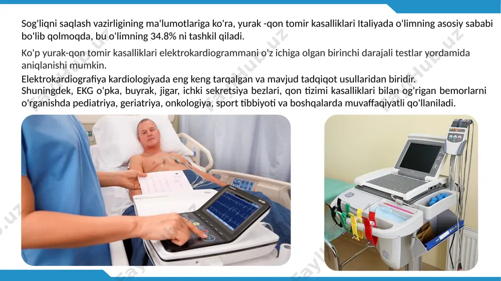 on rasmini to'ldirish zarurati mavjud; sportchining sog'lig'i holatini aniqlash uchun klinik baholarda sport faoliyati, shu jumladan musobaqali sport uchun sertifikat olish kerak; vaqt o'tishi bilan yurak xastaligining rivojlanishini baholash yoki davolanish samaradorligini tekshirish kerak. ekg bir necha daqiqa davom etadi. bemorning tanasiga (qo'llari, oyoqlari va ko'kragiga) yurakning elektr faolligini qayd etish uchun o'nta elektrod qo'yiladi. keyin elektrokardiograf buni mutaxassis tomonidan baholanadigan izda aks ettiradi. hech qanday elektr stimulyatsiyasi yo'q va og'riqsiz va invaziv bo'lmagan tekshiruvda maxsus kontrendikatsiyalar yo'q. ekspertiza(tashxis) qanday o'tkaziladi ekg simlarini ulash elektrodlarni ulash qizil kabel – o`ng` qo`lga sariq – chap qo`lga, zangori – chap oyoqqa, qora – o`ng oyoqqa, oq – ko'krak elektrodiga ekgni qanchalik tez -tez bajarish kerak? tekshiruv natijalariga, patologiyalar yoki xavf omillarining borligi yoki yo'qligiga qarab, tibbiy ko'rik va elektrokardiogramma qanchalik tez-tez o'tkazilishi mutaxassisga bog'liq. 40 yoshdan boshlab ularni har ikki yilda va 50 yildan keyin kamida yiliga bir marta o'tkazish maqsadga muvofiq …