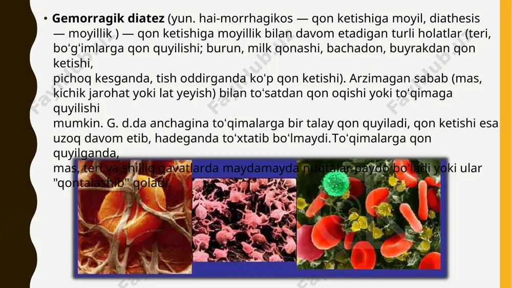 ezning sababi irsiy qoldiqdir. ikkinchi turdagi infektsion patologiyalar, sepsis , allergik reaktsiyalar, qon tomir devorlarining holatini yomonlashuviga va qon ivishining buzilishiga olib keladigan kasalliklar rivojlanadi. gemorragik diatezni farqlashda tibbiy doiralarda shunday tan olingan tasnifga e'tibor qaratish maqsadga muvofiq: xususiyatlarning o'zgarishi, trombotsitlar soni va ularning fiziologik vazifalari bilan bog'liq kasalliklar. qon tomirlari devorlarining o'tkazuvchanligi tufayli paydo bo'lgan patologiyalar. biologik suyuqlikning pıhtılaşma tizimidagi o'zgarishlar tufayli rivojlanadigan kasalliklar. • • • • • • ge morragik diate zn in g be lgil ari • • • • • • • • • • • • • • • ushbu kasallikning barcha navlari bilan, asosiy simptom qon ketish. uning xarakteri diathesiz shakliga bog'liq. trombotsitlar xususiyatlarining o'zgarishi hollarida bunday klinik belgilar kuzatiladi: tanada va oyoqlarda teri osti qon ketishi; paydo bo'lgan joylarning yorqin rangi (qizildan tortib to quyuq binafsha ranggacha); ichak, burun, oshqozon, bachadondan qon ketishga moyillik; ko'zning retinasida qon tomirlarini portlatib yuboradi, bu ko'pincha …
