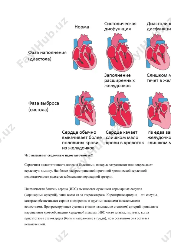 ови, богатой кислородом, к сердечной мышце, что приводит к необратимой гибели ткани. это повреждение влияет на насосную функцию сердца, приводя к сердечной недостаточности. большая часть пациентов также страдает от высокого кровяного давления, что дополнительно усугубляет ситуацию. высокое кровяное давление (гипертония) является единственной причиной сердечной недостаточности у почти 20% людей, что делает его второй наиболее распространенной причиной этого заболевания. высокое кровяное давление заставляет сердце постоянно работать сильнее. сердце не может работать под дополнительной нагрузкой в течение длительного периода времени, и поэтому деградирует. подобный эффект может быть вызван проблемой с сердечным клапаном. при суженных или протекающих аортальных клапанах сердце должно работать сильнее или биться чаще, что также ведет к увеличению нагрузки. брадикардия – нарушения сердечного ритма при котором снижена частота сердечных сокращений также может быть причиной сердечной недостаточности, поскольку циркулирует слишком мало крови. слишком быстрое сердцебиение (тахикардия) связано с уменьшением ударного объема и, следовательно, может также привести к сердечной недостаточности. наследственные заболевания …