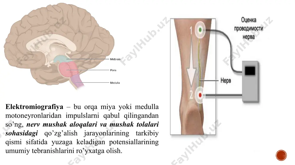 aklarning majburiy qisqarishi sodir bo'ladi. tuyg'ular g'ayrioddiy bo'lishi mumkin, ammo tadqiqotning aniqligi stimulning to'g'ri amplitudasiga bog'liq. igna, unda bir martalik maxsus igna elektrodlari qo'llaniladi, ular o'rganilayotgan mushak ichiga kiritiladi. sezgilar oddiy mushak ichiga in'ektsiyaga qaraganda ancha kamroq og'riqli. elektrod yordamida mushaklarning faolligi dam olish va kuchlanish ostida qayd etiladi. epilepsiya va ruhiy kasallikning mavjudligi odatda tadqiqotga qarshi ko'rsatma hisoblanadi. shifokorni o'rnatilgan yurak stimulyatori va impuls o'tkazuvchanligiga ta'sir qiluvchi dori-darmonlarni qabul qilish haqida ogohlantirish kerak. emg tadqiqotiga maxsus tayyorgarlik talab etilmaydi: o'rganilayotgan hududda kosmetika, malham, kremlardan foydalanish tavsiya etilmaydi, teri toza bo'lishi kerak. https://youtu.be/uawdlw6z4z4 yurakning qо‘zg‘algan va qо‘zg‘almagan qismlari о‘rtasida elektr potensiallarining farqi paydo bо‘lganda, elektr kuch chiziqlari butun tana bo’ylab taqsimlanadi. demak, tananing ma’lum nuqtalariga elektrod qо‘yib, potensiallar о‘zgarishining tipik elektr chiziqlarini qayd qilish mumkin bо‘lib, bu usul elektrokardiografiya deyiladi, yozib olingan egri chiziq esa, elektrokardiogramma deyiladi. elektrokardiografiya diagnostik usul bo’lib meditsinada keng qo’llanila boshladi, bu usul yurak faoliyatidagi bir …