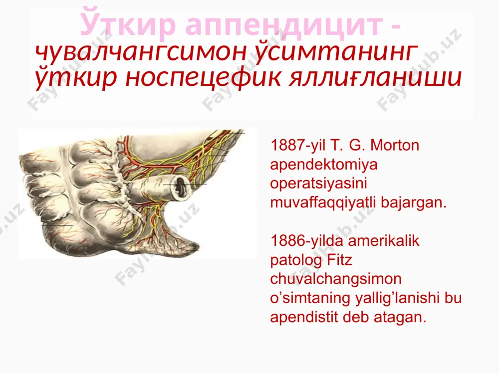 di) 1889-yil charlz mak-burney yozgan edi «meni fikrimcha, o’tkir appendistitda og’riqning eng sezilarli nuqtasi bir barmoq bilan bosilganda o’ng yonbosh suyagining oldingi-yuqori o’sig’i bilan kindik orasidagi chiziq orasidagi bir yarim, ikki dyuymni (3,8 va 5sm.) tashkil qiladi». 2. qusish o’tkir appendistitga reflektor bir yoki ikki marta qayt qilish xarakterli. faqat kichik yoshdagi (3 yoshgacha) bolalarda qayt qilish ko’p marotaba bo’lishi mumkin 3. ichak faoliyatining buzilishi bola yoshiga qarab turlicha bo’lishi mumkin. agar katta yoshdagi bolalarda qabziyat ko’p kuzatilsa, kichik yoshdagi bolalarda bir yoki ikki marotaba ich ketishi (diareya) kuzatilishi mumkin. qayt qilish va ichak funkstiyasining buzilishi ko’p jixatdan qorin parda yallig’lanishiga(kitiqlanishiga) bog’lik 3-yoshgacha bo`lgan bolalarda apenditsitning klinik ko`rinishi appenditsit xastaligi yangi tug`ilgan chaqaloqlarda to`satdan boshlanadi. ona bolaning bezovtalanishi, yig`lashi, ona kukragini olmaedi, tana haroratining 38-40c ga ko`tarilganligi, bir necha marta qusganligi, kam harakatligidan shikoyat qiladi. kasallik boshlanishida ichning suyuq kelishi kuzatiladi. bolada butun qorin devori bo’ylab o’g’riq, eksikoz, ko’p qusish …