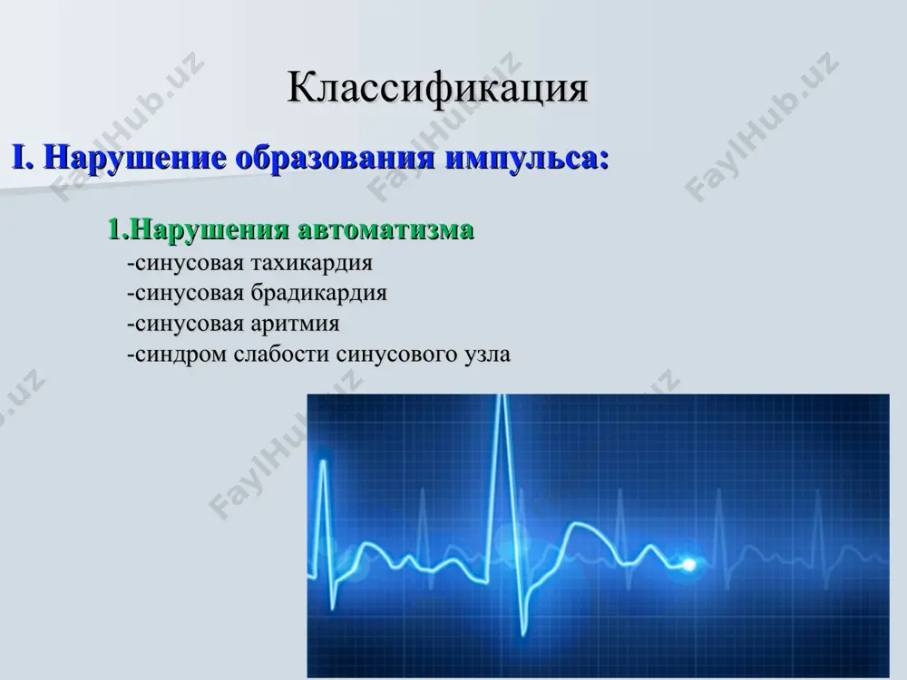 ожих друг на друга предсердных волн f, имеющих характерную пилообразную форму (лучше выявляются в отведениях ii, v1, v2) в большинстве случаев правильный, регулярный желудочковый ритм с одинаковыми интервалами rr нормальные желудочковые комплексы, каждому qrs предшествует определенное (чаще постоянное) количество предсердных волн f. чсс 100, ритм не правильный (не синусовый) rr≠rr, р нет, f волны, pq (-), qrs 0.08“, st изоэлектричен, т(+), qt 0,25". инверсия зубцов сохранена. переходная зона v3. заключение: трепетание предсердий. мерцание (фибрилляция) предсердий зубца р - нет беспорядочные мелкие волн f различной формы и амплитуды, лучше регистрируются в отведениях ii, v1, v2 интервалы rr хаотично не равны, комплексы qrs – могут отличатся по амплитуде зубца r (аберрация) в одном отведении. без уширения. чсс 100, ритм не правильный (не синусовый) rr≠rr, р нет, f волны, pq (-), qrs 0.08“, st изоэлектричен, т(+), qt 0,25". инверсия зубцов сохранена. переходная зона v3. заключение: мерцание предсердий. трепетание и мерцание (фибрилляция) желудочков при …