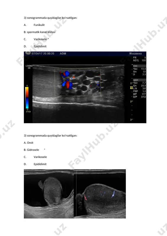 prostata adenomasi - Page 2