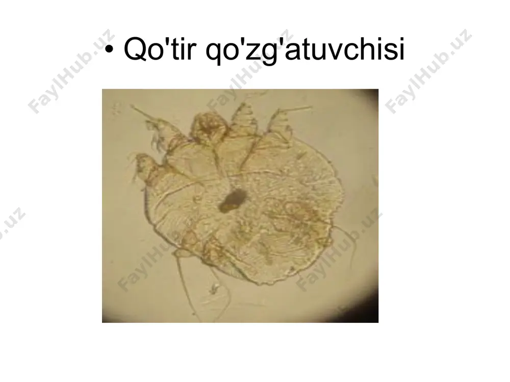 qo'zg'atuvchisi (sarcoptes scabiei) - Page 4