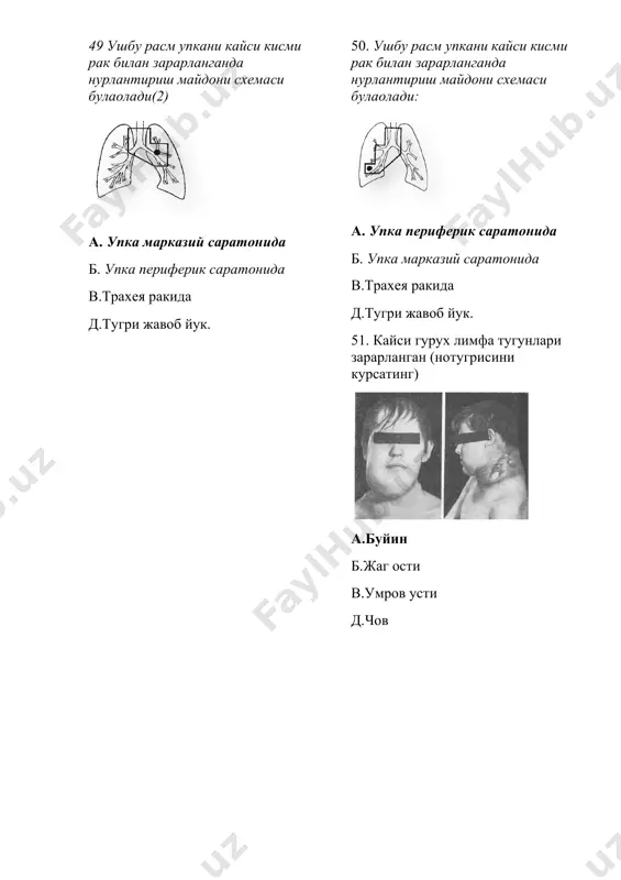 oshqozon saratonining metastazlari - Page 5