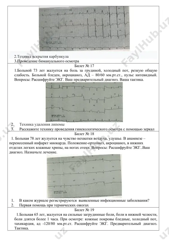ая 72 лет страдает гипертонической болезнью, жалуется на периодические повышения ад до 170/100 – 180/100 мм рт.ст., головные боли, головокружения. снята экг. вопросы: расшифруйте экг. ваш диагноз. лечебная тактика. 2. техника вскрытия карбункула 3.как называется ф-029-/у и кем заполняется ? билет № 25 1. техника сниятия экг 2. удаление вросшего ногтя 3. расскажите технику проведения бимануального (двуручного) исследования гинекологических больных билет № 26 1. техника проведения офтальмоскопии 2. техника естественного (грудного) вскармливания 3.осмотр шейки матки в зеркалах билет № 27 1. анализ рентгенограмм сустава 2. техника проведения офтальмоскопии 3. осмотр шейки матки в зеркалах билет № 28 1. алгоритм действий при поствакцинальной реакции 2. регистрация экг 3. расскажите технику определения и оценку степени чистоты влагалища билет № 29 1. неотложная помошь при гипертермии 2. расшифровка экг 3. методика измерения базальной температуры билет № 30 1. безусловные рефлексы новорожденных 2. техника проведения офтальмоскопии 3. расскажите технику проведения гинекологического осмотра с помощью …