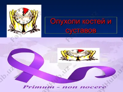 опухоли костей и суставов — PPT