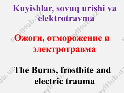 kuyishlar, sovuq urishi va elektrotravma — PPTX