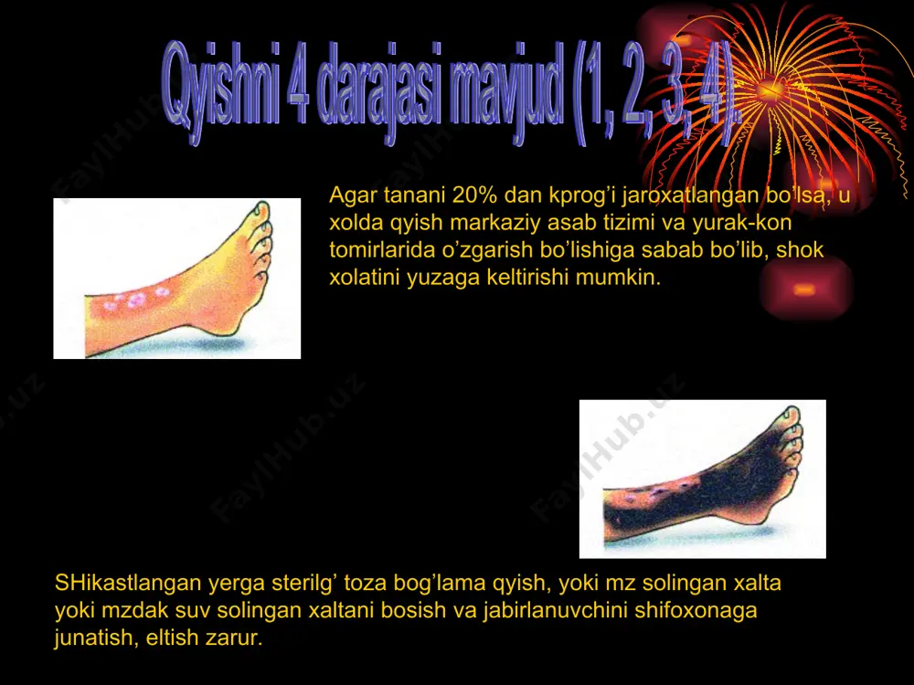 kuyish darajalari. kuyish maydonini aniqlash - Page 4