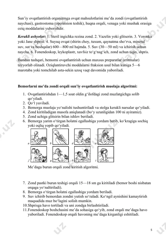, b, d, e). og‘ir yotgan bemorlarni sun’iy ovqatlantirish. sun’iy ovqatlantirish organizmga ovqat mahsulotlarini me’da zondi (ovqatlantirish naychasi), gastrostoma (operatsion teshik), huqna orqali, venaga yoki mushak orasiga oziq moddalarini yuborishdir. kerakli ashyolar: 1. steril ingichka rezina zond. 2. vazelin yoki glitserin. 3. voronka yoki jane shprisi. 4. suyuq ovqat (shirin choy, tuxum, qaynatma sho‘rva, mineral suv, sut va boshqalar) 600—800 ml hajmda. 5. suv (30—50 ml) va ichirish uchun naycha. 6. fonendoskop, leykoplastr, xavfsiz to‘g‘nag‘ich, zond uchun tiqin, shpris. bundan tashqari, bemorni ovqatlantirish uchun maxsus preparatlar (eritmalar) tayyorlab olinadi. oziqlantiruvchi moddalarni fraksion usul bilan kuniga 5—6 marotaba yoki tomchilab asta-sekin uzoq vaqt davomida yuboriladi. bemorlarni me’da zondi orqali sun’iy ovqatlantirish muolaja algoritmi: 1. ovqatlantirishdan 1—1,5 soat oldin g‘ilofdagi zond muzlatgichga solib qo‘yiladi. 2. qo‘l yuviladi. 3. bemorga muolaja yo‘nalishi tushuntiriladi va stolga kerakli narsalar qo‘yiladi. 4. zond kiritiladigan masofa aniqlanadi (bo‘y uzunligidan 100 ni ayiramiz). 5. zond uchiga glitsirin bilan …