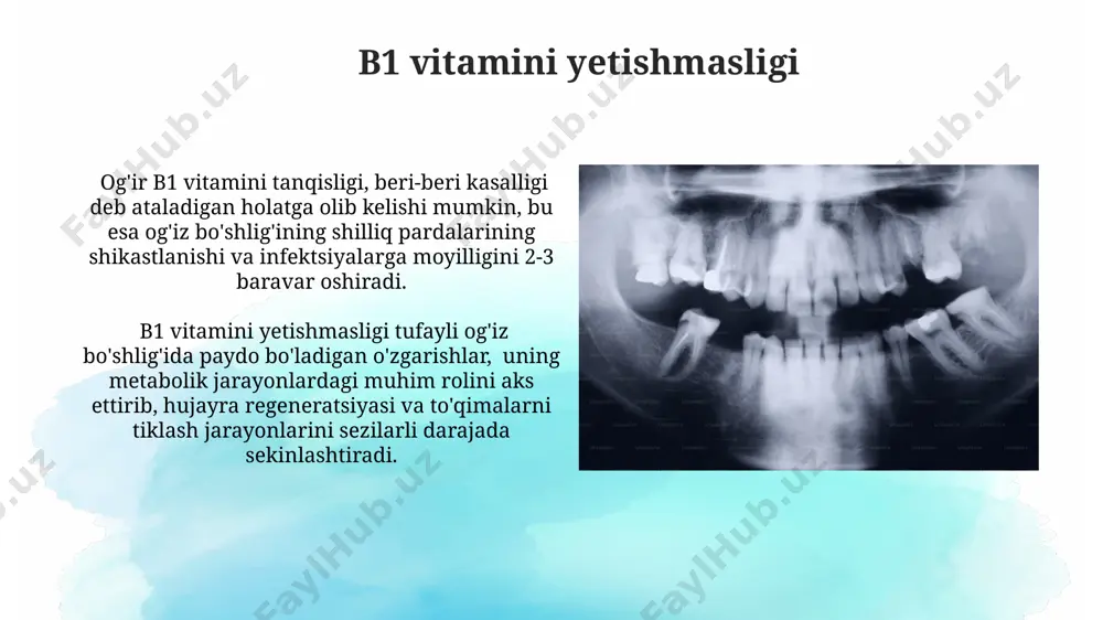 hisoblanadi. a vitamini yetishmasligi a vitamini yetishmasligi og'iz bo'shlig'ida 30% hollarda cheilit (lablarning yorilishi) va glossitis (tilning yallig'lanishi) kabi o'zgarishlarga olib kelishi mumkin, bu esa og'riq va ovqatlanish qiyinchiliklarini keltirib chiqaradi. a vitamini tanqisligi tufayli og'iz shilliq qavatining quruqligi va epiteliy qatlami yupqalashuvi kuzatiladi, bu esa infektsiyalar xavfini 2-3 baravar oshiradi. ogʻiz boʻshligʻi oʻzgarishlarining umumiy tavsifi vitamin yetishmovchiligi fonida ogʻiz shilliq qavatining giperemiya, quruqlik, kuchli ogʻriq hissi (disgeuziya) bilan birga kelishi mumkin. avitaminoslarda tilning atrofiyasi, papilla atrofiyasi, glositis, xeylit kabi oʻzgarishlar, shuningdek, 2-3 darajali burun-lab burmalarining chuqurlashuvi kuzatiladi. biotin yetishmasligi biotin defitsitining og'iz bo'shlig'idagi namoyon bo'lishi, boshqa b vitaminlari yetishmasligi bilan birga kuzatilganda, klinik belgilarning og'irligi 2-3 baravar ortishi mumkin. biotin yetishmasligi og'iz bo'shlig'ida cheilit, glosit va stomatit kabi yallig'lanish o'zgarishlariga, shuningdek, tilning qizarishi va shishishiga olib kelishi mumkin. b12 vitamini yetishmasligi b12 vitamini yetishmasligi og'iz bo'shlig'ida glositis, ya'ni tilning yallig'lanishi va shishishiga, shuningdek, 20-30% hollarda atrofik glossitisga olib kelishi …