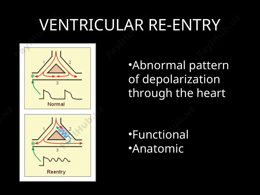 g to focus on classes i and iii because these are the ones affecting the action potential directly so they will be most useful in these re-entry circuits * how these drugs affect re-entry class i: retards conduction enough so that beat still gets through normal cardiac tissue but not through any weakened tissue class iii: prolongs refractoriness the class i drugs can completely block conduction through the weakened tissue. since the weakened tissue isn’t going to block an entire pathway through the hear, just enough of one to cause some mischief, the wavefront will still be able to propogate in the surrounding normal tissue the class iii drugs prolong repolarization so the re-entry circuit will still begin to develop, but since only one side will have the issue, when the wave has circled all the way back around the cells that are slowed down still will not have recovered, …