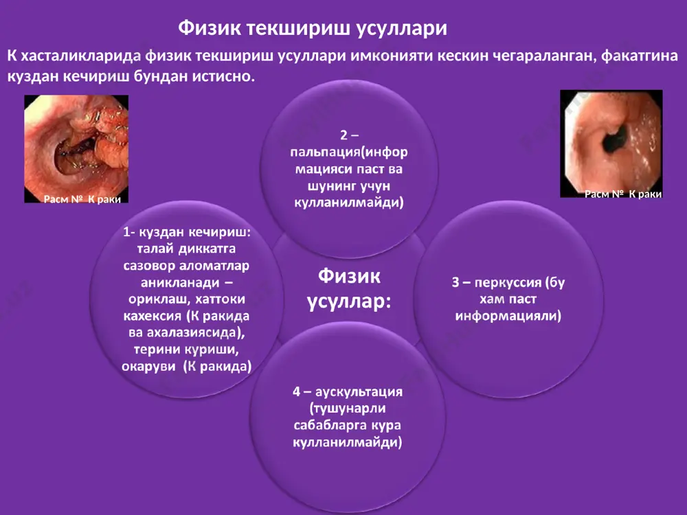 лари (куздан кечириш, пальпация, перкуссия, аускультация) назорат давомида корин шаклига(тугри, нотугри, асимметрик) ва улчамларига(ичкарига тортилган еки дуппайиб чиккан, умумий еки локал дам), киндик, тери, ва тери ости клечаткаси холатига эътибор бериш лозим. расм № ичак хасталикларида огрикни таркалиш сохалари киндик сохасига огрик одатан ингичка ичак, аппендикс ва йугон ичак проксимал кисми жарохатларида таркалади гипогастр сохасига огрик йугон ичак, сийдик пуфаги сийдик йуллари хасталик- ларида таркалади.йугон ичак хасталикларига мансуб огрик таркалиш доираси кенгрокдир ков сохасига огрик тугри ичак касал-ликларида таркалади «проклятый живот, приносящий человеку самые большие страдание» гомер, одиссея, xv.344 корин назорати давомида аникланиши мумкин булган тузилмалар расм № кориннинг локал йириклашуви (чурра) расм № киндик чурраси расм № рекленгаузен касаллиги (липоматоз) расм № корин бушлиги усмаси тимпаник перкутор товуш тумток перкутор товуш расм № юзаки пальпация методикаси расм № чукур пальпация методикаси пальпация нисбатан бой информацияга эга ва уни бажариш техникаси расм № ларда акс эттирилган. пальпация: коринни юзаки ва …
