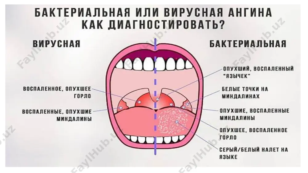 anginalar mavzusi - Page 4