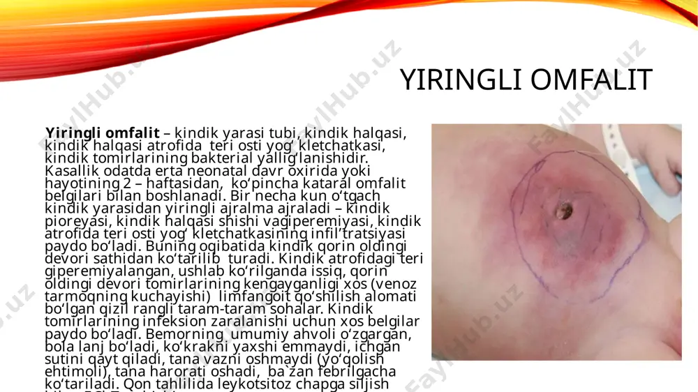 halik portal gipertenziya paydo bo‘lishi mumkin. davosi pufaklarni obrabotka qilish uchun qo‘lga steril qo‘lqoplar kiyiladi. terining jarohatlangan joyini 2,5 %li povidon yod antiseptik eritmasida, 4% li xlorgeksidin glyukonat yoki 60-90% li etil, izopropil spirtida yuviladi. so‘ng pufaklarni 0,5 %li gentsian violeti eritmasida obrabotka qilinadi. shu muolajani kuniga 4 mahal, pufaklar bitib ketmagunicha qaytariladi. agar pufaklar 5 kun mobaynida bitib ketsa,bolani uyiga jo‘natiladi.agar pufaklar ko‘p miqdorda saqlanib tursa, bolaga og‘iz orqali kloksatsillin 50mg/kg har 8 soatda 5 kun mobaynida beriladi. agar bola tanasida 10 tadan ko‘p pufaklar bo‘lsa yoki ular tana sathining yarmidan ko‘pini tashkil qilsa, steril lantsetni ishlatgan holda pufakning qoq markazini teshiladi. bakteriologik tekshiruv va antibiotikka sezuvchanligini aniqlash maqsadida steril paxtaga yiring olinadi. terining jarohatlangan joylariga mahalliy ishlov beriladi, mushak orasiga 50mg/kg (0,5ml/kg) kloksatsillin jo‘natiladi. flegmonani jarroh tomonidan davolanadi, drenaj urnatiladi. kloksatsillin mushak orasiga jo‘natiladi.yiring ekmasi natijasi musbat bo‘lsa, sezuvchanligiga monand ravishda antibiotik ko‘llaniladi. noinfeksion kasalliklari kindik churrasi (hernia …