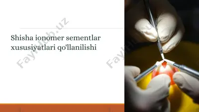 shisha ionomer sementlar  xususiyatlari qo'llanilishi — PPTX