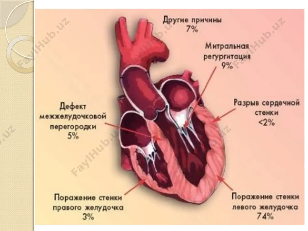 kardiogen shok klinikasi va davo choralari - Page 5