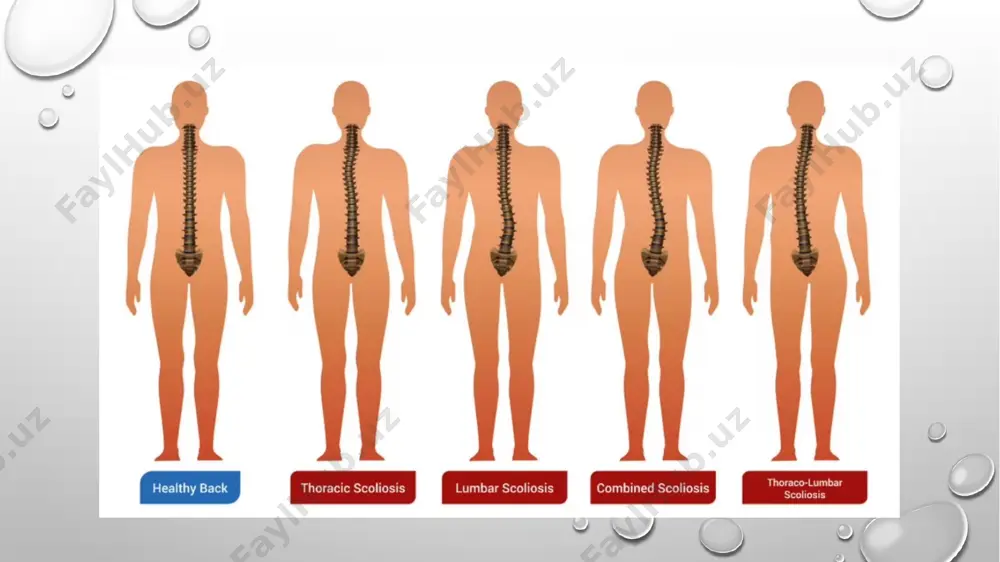 it-rezonans tomografiya (mri)magnit-rezonans tomografiya (mri) - elektromagnit to'lqinlar yordamida to'qimalar va organlarning tasvirlarini olishga asoslangan zamonaviy, yuqori informatsion tadqiqot usuli. ushbu diagnostika usuli mutlaqo xavfsizdir va agar kerak bo'lsa, bitta bemorda qayta-qayta qo'llanilishi mumkin. tomografiya natijasida olingan raqamli ma'lumotlar kompyuterda qayta ishlanadi. mri tasviri bir qator uzunlamasına va ko'ndalang bo'limlar sifatida taqdim etiladi.mri yumshoq to'qimalarda, masalan, nerv tuzilmalari, ligamentlar va mushaklardagi patologik o'zgarishlarni tashxislash uchun "oltin standart" hisoblanadi. mri intervertebral disklardagi degenerativ o'zgarishlarni, faset bo'g'imlarining gipertrofiyasini, orqa miya stenozini, disk churrasini va boshqa patologik sharoitlarni aniqlashi mumkin. mrt kompyuter tomografiya kompyuter tomografiyasi (kt) kompyuter tomografiyasi an'anaviy rentgenografiya kabi to'qimalar va organlarni tasvirlash uchun rentgen nurlaridan foydalanadi. olingan ma'lumotlar kompyuterda qayta ishlanadi, buning natijasida tasvir bir qator uzunlamasına va ko'ndalang kesimlar shaklida taqdim etiladi. kompyuter tomografiyasi ham suyak tuzilmalarini, ham yumshoq to'qimalarni tekshirishi mumkin.biroq, kt hali ham suyak to'qimalarida patologik o'zgarishlarni aniqlash uchun eng informatsion hisoblanadi, masalan, osteofitlar va faset bo'g'imlarining …