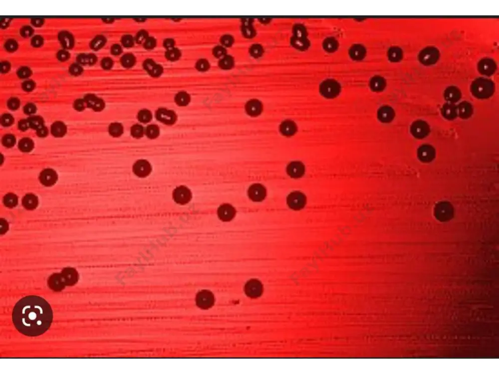haemophilus influenzae vaktsinalari - Page 4
