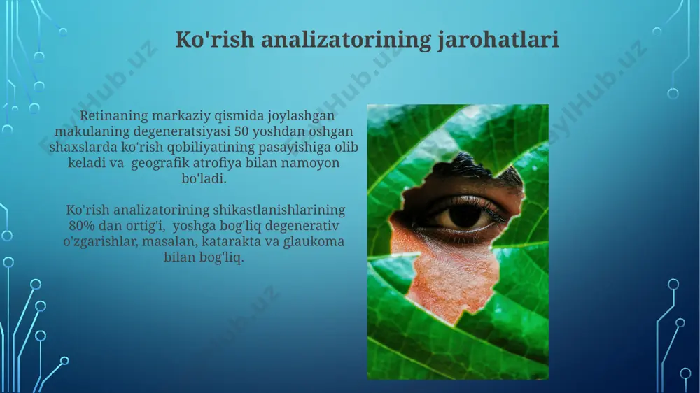i tufayli, miyopiyada retina ustida tasvirning aniq fokalizatsiyasi buziladi, bu esa ko'rish keskinligining pasayishiga olib keladi, shuningdek, -3,0 dioptriyadan yuqori darajadagi miyopiya xavfli hisoblanadi. ko'zning o'sishi va rivojlanishi davrida, ya'ni 6-12 yosh oralig'ida ko'p vaqt yaqin masofadagi ishlarga sarflanishi, miyopiya rivojlanish xavfini sezilarli darajada oshiradi, bu esa aksual uzunlikni oshiradi. ko'rish analizatorining tug'ma anomaliyalari mikroftalmiya, ko'zning g'ayritabiiy kichik o'lchamlarini ifodalovchi tug'ma nuqson, ko'rish funksiyasining jiddiy buzilishiga, shu jumladan, ambliyopiyaga olib kelishi mumkin. albinizm, melanin pigmentining etishmasligi bilan tavsiflanadigan genetik kasallik, ko'rish analizatorining tug'ma anomaliyalariga misol bo'lib, taxminan 1:17000 tug'ilish chastotasiga ega. retinit pigmentosa retinit pigmentosa, ko'z retinasining asta-sekin degeneratsiyasi bo'lib, taxminan 1 dan 40000 gacha odamga ta'sir qiladi va kechasi ko'rish qobiliyatining pasayishi bilan boshlanadi. retinit pigmentosa bilan og'rigan bemorlarda periferik ko'rish maydonining torayishi kuzatiladi va bu holat asta-sekin rivojlanib, 50 yoshga kelib markaziy ko'rishga ham ta'sir qilishi mumkin. astigmatizmning patogenezi astigmatizm rivojlanishida embrional rivojlanish davridagi genetik mutatsiyalar va atrof-muhit …