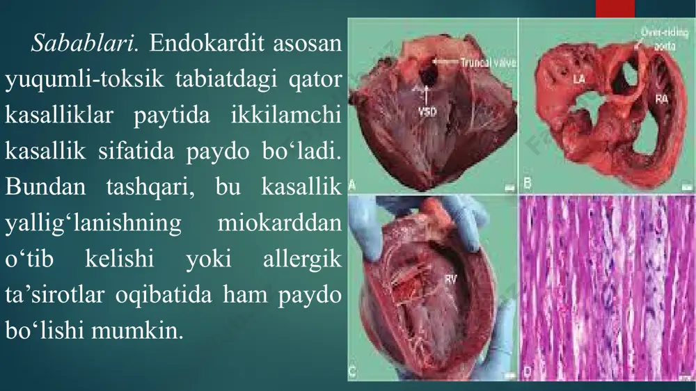 tlari tavsiya etiladi. allergik xususiyatli endokarditni davolashda salisilatlar, amidopirin, kalsiy xlorid, dimedrol va allergiyaga qarshi boshqa dorilar, i.i.kadыkov kamforali zardobi (1 gkamfora, 75 ml 96 0li etil spirti, 15 g glyukoza,125 ml fiziologik eritma qo‘llaniladi. o‘tkir endokarditda otlar trening yoki ishdan to‘liq ozod qilinib, yurak sohasiga sovuq bosish va kislorodoterapiya tavsiya etiladi. keyinchalik, kamfora, glyukoza, spirt, natriy xloridning izotonik eritmasi, kofein va yurak glikozidlarini ishlatishga asoslangan davolash muolajalari belgilanadi. yurak qon-tomir tizimi a’zolari organizmni kislorod, oziqa moddalar va suv bilan ta’minlaydi hamda to‘qimalardan metabolizm mahsulotlarini chiqaruv a’zolariga etkazib beradi. tizim kasalliklari paytida ish qobiliyati va mahsuldorlikni pasayishi, holsizlanish, haroratni ko‘tarilishi va ishtahani pasayishi kabi umumiy belgilar bilan birgalikda aritmiya, xansirash, sianoz, yurak shovqinlari va shishlar paydo bo‘lishi kabi patognomonik belgilar kuzatiladi. aritmiyaning asosiy belgilari yurak qisqarishlari chastotasi, ketma- ketligi va kuchining o‘zgarishi hisoblanadi. aritmiyalarning kelib chiqishi ko‘pincha yurakni o‘tkazuvchi sistemasining funksional yoki anatomik jarohatlanishi oqibatida kuzatiladi. o‘pkada qon harakatining susayishi …