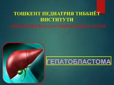 bolalarda uchraydigan havfli oʻsmalar. gepatoblastoma — PPTX