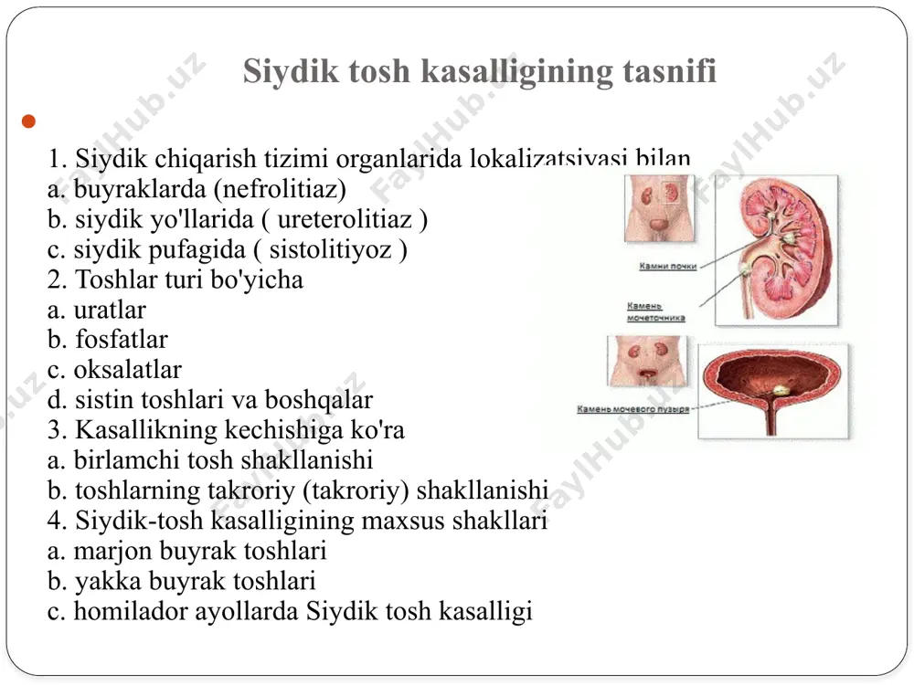 chiqarishni to'xtatish siydik pufagi va siydik yo'lidagi toshlar bilan paydo bo'lishi mumkin. pyuriya ( leykotsituriya ): siydikda leykotsitlar sonining ko'payishi - siydik yo'llari infektsiyasining qo'shilishidan dalolat beradi. postrenal anuriya : siydik chiqishining buzilishi tufayli siydik etishmasligi - ikkala siydik yo'lida toshlar mavjudligi yoki bitta buyrakning siydik yo'lida tosh borligi bilan mumkin. postrenal anuriya shoshilinch davolash choralarini talab qiladi. diagnostika laboratoriya diagnostikasi: umumiy qon tahlili. odatda, siydik tosh kasalligi bilan umumiy qon testida o'zgarishlar kuzatilmaydi. ammo, agar buyrak sanchig'i paydo bo'lsa yoki pielonefrit rivojlansa, leykotsitoz (leykotsitlar sonining ko'payishi), leykotsitlar formulasining o'zgarishi va esrning oshishi kuzatilishi mumkin. umumiy siydik tahlili: yengil proteinuriya (siydikda oqsil mavjudligi), mikrogematuriya (siydikda qizil qon tanachalari mavjudligi) va bitta tsilindrni kuzatish mumkin. leykotsituriya va bakteriuriya birlashtiriladi . biroq, buyrak sanchig'i bilan siydik miqdori normal bo'lishi mumkin, chunki toshlar ma'lum bir buyrakdan siydik oqimini butunlay to'sib qo'yishi mumkin. tuz kristallari. epizodik aniqlanishi mumkin va ko'pincha ovqatlanish va siydik ph …