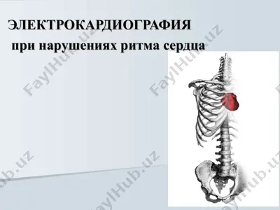 электрокардиография — PPT