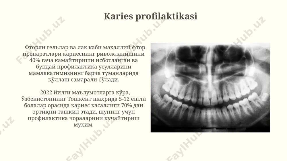 karies kasalligi va profilaktikasi - Page 5