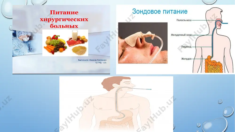 gi ichidan qizilungach, kеyin оshqоzоn tоmоn yubоriladi. zоnd оshqоzоndaligiga amin bo’lish lоzim. entеral оziqlantirishga qarshi ko’rsatmalar: 1.оbturatsiоn o’tkir ichak tutilishi. 2.ichak ishеmiyasi 3.ichaklararо anastоmоz еtishmоvchiligi 4.entеral оzuka kоmpоnеntlarini o’zlashtira оlmasligi 5.nazоgastral zоnddan 1200 ml dan kup yubоrilishi taomnoma. suyuq taomlar. . sutli maxsulotlar image2.png image4.png image3.png image5.png image6.png image7.png image8.png image9.png image10.png image11.png image12.png image13.png image14.png image15.png image16.png image17.png image18.png image19.png image20.png image21.png image22.png image23.png image24.png image25.png image26.png image27.png image28.png image29.png image30.png image31.png image1.png /docprops/thumbnail.jpeg