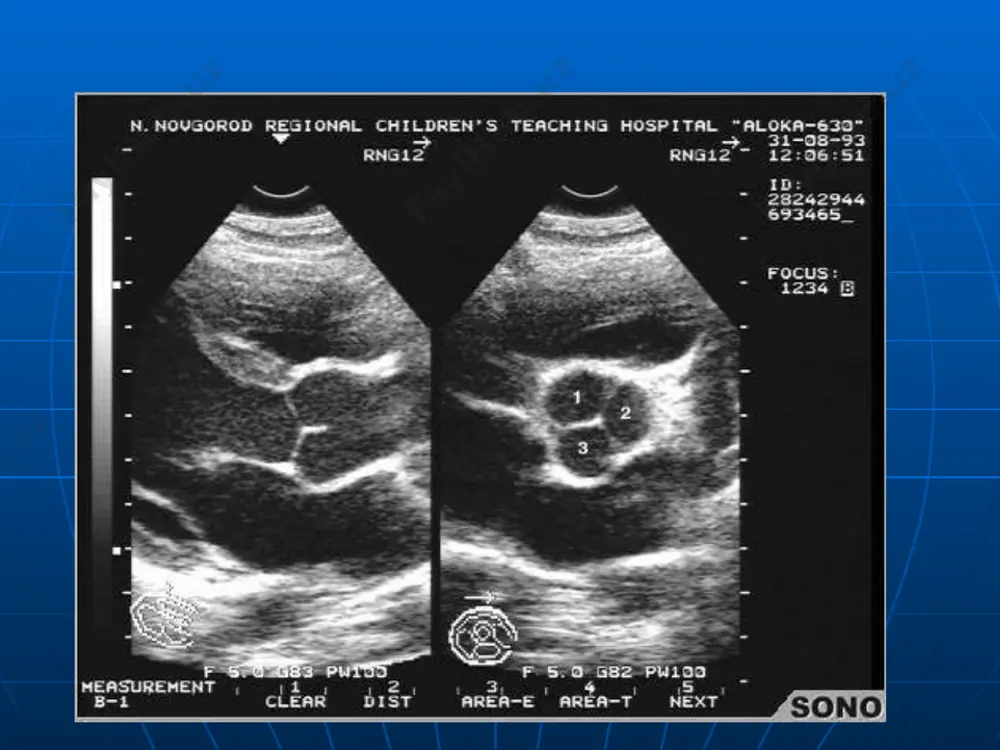 ultrasonografiya (ehokardiografiya) - Page 5
