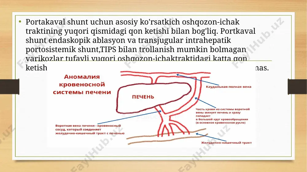 portakaval shunt - Page 4
