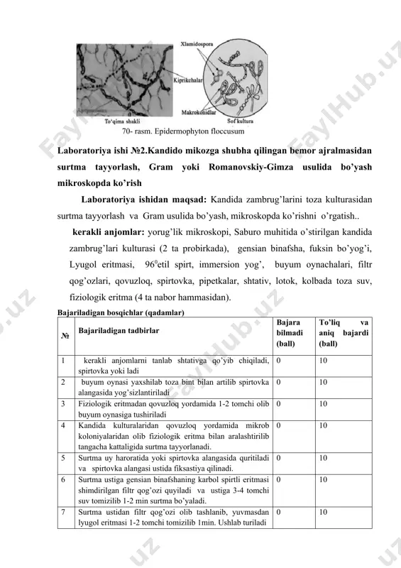ik mikroskopi, saburo muhitida o’stirilgan kandida zambrug’lari kulturasi (2 ta probirkada), gensian binafsha, fuksin bo’yog’i, lyugol eritmasi, 960etil spirt, immersion yog’, buyum oynachalari, filtr qog’ozlari, qovuzloq, spirtovka, pipetkalar, shtativ, lotok, kolbada toza suv, fiziologik eritma (4 ta nabor hammasidan). bajariladigan bosqichlar (qadamlar) № bajariladigan tadbirlar bajara bilmadi (ball) to’liq va aniq bajardi (ball) 1 kerakli anjomlarni tanlab shtativga qo’yib chiqiladi, spirtovka yoki ladi 0 10 2 buyum oynasi yaxshilab toza bint bilan artilib spirtovka alangasida yog’sizlantiriladi 0 10 3 fiziologik eritmadan qovuzloq yordamida 1-2 tomchi olib buyum oynasiga tushiriladi 0 10 4 kandida kulturalaridan qovuzloq yordamida mikrob koloniyalaridan olib fiziologik eritma bilan aralashtirilib tangacha kattaligida surtma tayyorlanadi. 0 10 5 surtma uy haroratida yoki spirtovka alangasida quritiladi va spirtovka alangasi ustida fiksastiya qilinadi. 0 10 6 surtma ustiga gensian binafshaning karbol spirtli eritmasi shimdirilgan filtr qog’ozi quyiladi va ustiga 3-4 tomchi suv tomizilib 1-2 min surtma bo’yaladi. 0 10 7 …