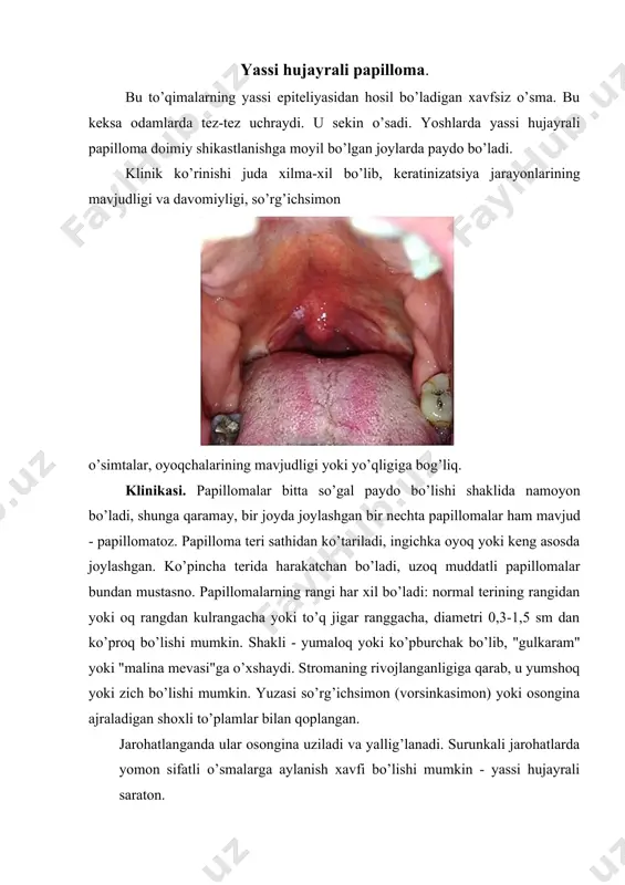 yuzasi ajinlangan, biroz pigmentli, sochsiz teri bilan ifodalangan bo’ladi; · papilloma vulgar so’gallardan insonning yuz va tana qismlarida ko’proq joylashishi va o’rta va keksa yoshdagi bemorlarda uchrashi bilan farq qiladi. shuningdek, ushbu kasalliklarning farqi elementlarning soni va ularning mavjud bo’lish davomiyligidadir. papillomalar bitta yoki ko’p bo’lishi mumkin va o’nlab yillar davomida mavjud bo’lib, so’gallardek o’zo’zidan yo’qolishi mumkin. gistologik tuzilishida ham farq bor; · seboreyalik keratoz to’q rangli, elementlarning katta miqdori, tananing yopiq joylarida bo’lishi bilan farqlanadi. ko’pincha seboreyalik keratoz kuchli giperkeratik hosilalar bilan kechadi. seboreyalik keratozda sirti mumsimon yaltirash mavjud, bu papillomada kuzatilmaydi; · qarilik keratomasida shikastlanishlar tananing ochiq joylarida joylashgan bo’lib va zich qobiqlar bilan qoplanadi, ularni olib tashlangandan so’ng qattiqlashgan qontalash bo’lgan asos paydo bo’ladi; · ko’p giperkeratozlangan teri shoxi bilan, mustahkam o’rnashgan muguzlarlar mavjud, papilloma bilan farqlanishi ular osongina ko’chadi. palpatsiya paytida teri shoxi zich, harakatsiz; · fibroma va papilloma o’rtasidagi farq fibroma tavsifida berilgan. davolash. jarrohlik …