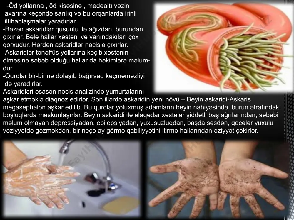 lar fiziki inkişafdan geri qala bilər, iştah pozulması, arıqlama, gözlərin zəif- ləməsi, dəridə səpkilər, sızanaqlar, qaşınmalar, saçların tökülməsi, yuxusuzluq, nevroz, menstruasiya pozulması, sonsuzluq, uşaq salma, kişilərdə cinsi zəiflik, spermin keyfiyətinin pozulması və s. bəzi xəstələrdə gücənməkdən düz bağırsaq çölə çıxir. onda, bağırsağa zəli kimi yapışmış qurd- ları görmək olur. tükbaş qurdları apendisitin əsas səbəblərindən biridirlər. bu qurdlar hətda bağırsağı tam deşıb, çox təhlükəli peritonit də törədə bilirlər. tükbaşların yumurtaları nəcisdə tapılanda, qurda qarşı müalicə edirlər. dərmanlar tükbaşlara əksər hallarda təsir etmir. lambliya (lamblia intestinalis) lambliya tək hüceyrəli parazitdir. lambliya- ların xəstəlik törədən vegetativ formaları 12 barmaq bağırsaqda və nazik bağırsağın yuxari hissələrində yaşayirlar. onlar bağırsağın sət- hinə yapışıb, qidalanırlar, çoxalırlar. miqdarları milyardlarla olur. çox olduqlarına görə bağırsağın səthini zədələyirlər. nəticədə, qidanın həzmi,mənimsənməsi, vitaminlərin, mineralların qana sorulması pozulur. lambli- yalar ödün və mədə altı vəzin şirəsinin 12 barmaq bağırsağa axmasına da mane olurlar. ona görə də, öd kisəsində durğunluq və öd …