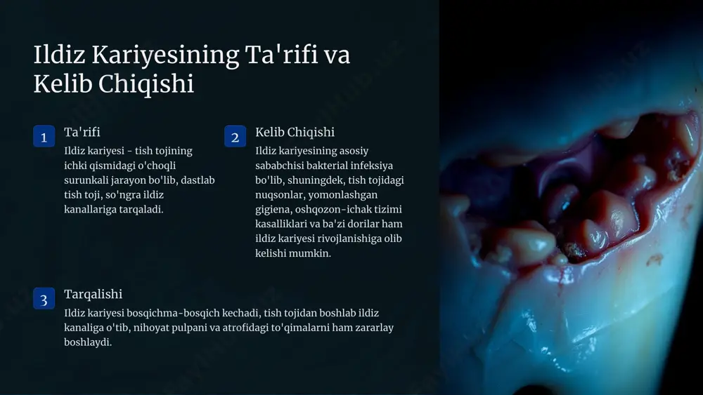 ganidan so'ng tish qayta tiniklashi, qoplashi yoki protezlanishi lozim. https://gamma.app/?utm_source=made-with-gamma ildiz kariyesini konservativ davolash farmakoterapiya antibiotiklar, analgetiklar, yallig'lanishga qarshi dorilar tavsiya etiladi. og'riqni bosish va infeksiyani bartaraf etish uchun ular qo'llaniladi. pulpa devitalisatsiyasi og'riq bo'lmagan hollarda ildiz kanallariga devitallashtiruv moylar yurgaziladi, pulpaning nobud bo'lishiga olib keladi. vaqtinchalik plombalash ildiz kanalining vaqtinchalik plombalangan bo'lishi, infeksiyani bartaraf etishga yordam beradi. bu davolanishni to'liq amalga oshirishga qadar o'tkaziladi. https://gamma.app/?utm_source=made-with-gamma ildiz kariyesi bilan kasallangan bemorlarni kuzatish muntazam kuzatuv ildiz kariyesi bilan kasallangan bemorlarni muntazam ravishda kuzatish va tekshirish muhim, chunki bu kasallik davomida turli asoratlar yuzaga kelishi mumkin. keyingi muolaja tavsiya qilish agar zarur bo'lsa, qo'shimcha muolaja (masalan, qayta ildiz kanalini davolash, tish qoplami yoki protezlash) tavsiya qilinadi. ogohlantirish va maslahat berish bemor ildiz kariyesi va uning asoratlari haqida to'liq ma'lumotlarga ega bo'lishi, shuningdek, kasallikni oldini olish bo'yicha maslahatlar olishi kerak. https://gamma.app/?utm_source=made-with-gamma